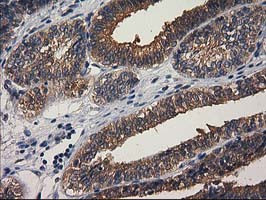 GBA3 Antibody in Immunohistochemistry (Paraffin) (IHC (P))