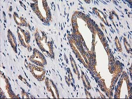 GBA3 Antibody in Immunohistochemistry (Paraffin) (IHC (P))