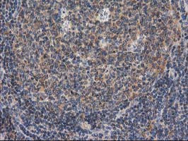 GBA3 Antibody in Immunohistochemistry (Paraffin) (IHC (P))