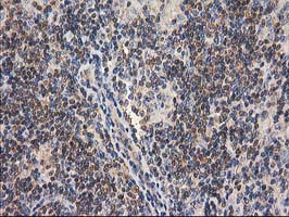 GBA3 Antibody in Immunohistochemistry (Paraffin) (IHC (P))