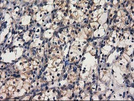 GBA3 Antibody in Immunohistochemistry (Paraffin) (IHC (P))