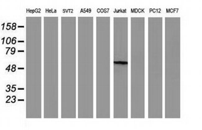 GBA3 Antibody in Western Blot (WB)