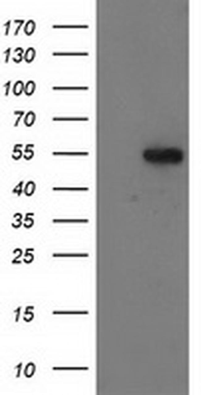 GBA3 Antibody in Western Blot (WB)