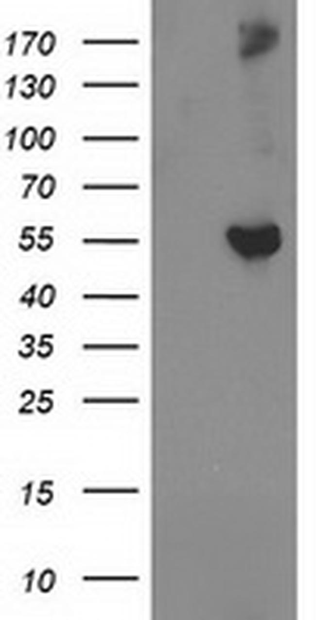 GBA3 Antibody in Western Blot (WB)