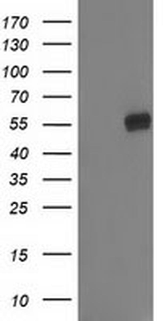 GBA3 Antibody in Western Blot (WB)