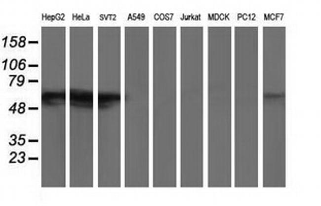 GBA3 Antibody in Western Blot (WB)