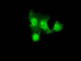 GBE1 Antibody in Immunocytochemistry (ICC/IF)