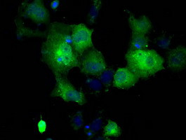 GBE1 Antibody in Immunocytochemistry (ICC/IF)