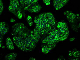 GBE1 Antibody in Immunocytochemistry (ICC/IF)