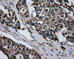 GBE1 Antibody in Immunohistochemistry (Paraffin) (IHC (P))