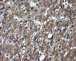 GBE1 Antibody in Immunohistochemistry (Paraffin) (IHC (P))