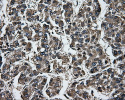 GBE1 Antibody in Immunohistochemistry (Paraffin) (IHC (P))