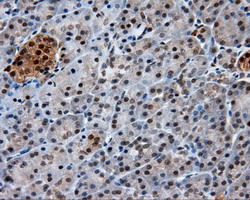 GBE1 Antibody in Immunohistochemistry (Paraffin) (IHC (P))