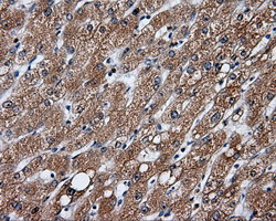 GBE1 Antibody in Immunohistochemistry (Paraffin) (IHC (P))