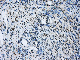 GBE1 Antibody in Immunohistochemistry (Paraffin) (IHC (P))