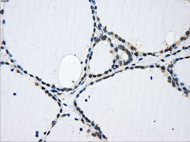 GBE1 Antibody in Immunohistochemistry (Paraffin) (IHC (P))