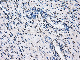 GBE1 Antibody in Immunohistochemistry (Paraffin) (IHC (P))