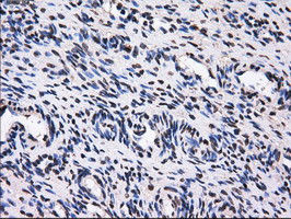 GBE1 Antibody in Immunohistochemistry (Paraffin) (IHC (P))