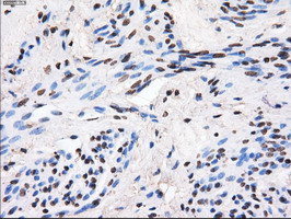 GBE1 Antibody in Immunohistochemistry (Paraffin) (IHC (P))