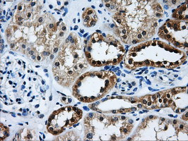 GBE1 Antibody in Immunohistochemistry (Paraffin) (IHC (P))