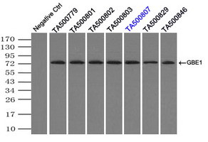 GBE1 Antibody in Immunoprecipitation (IP)