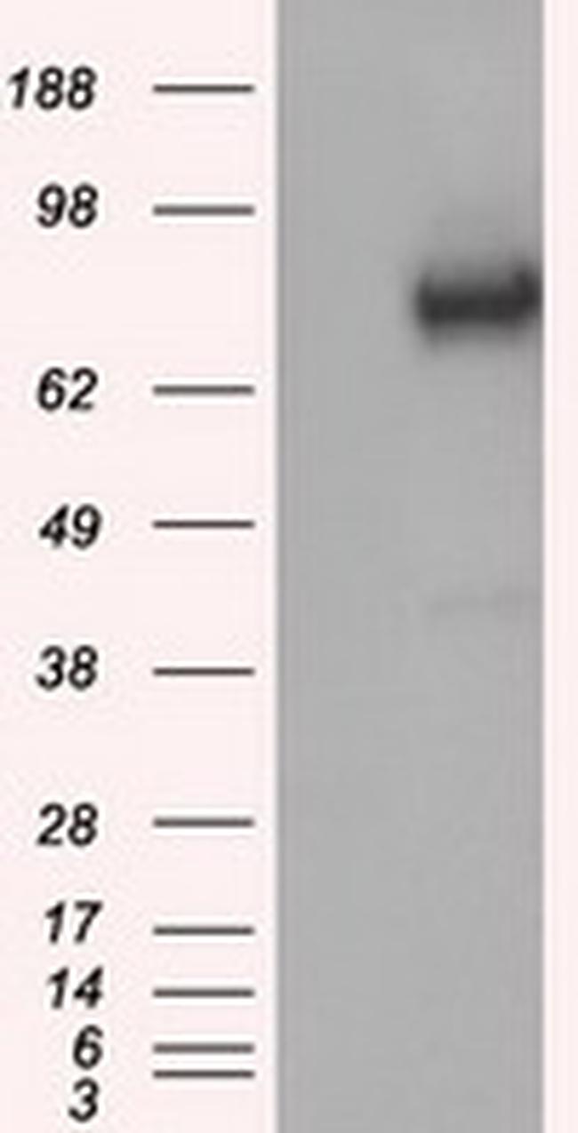 GBE1 Antibody in Western Blot (WB)