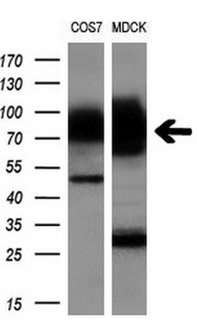 GBE1 Antibody in Western Blot (WB)