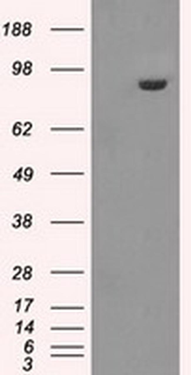 GBE1 Antibody in Western Blot (WB)