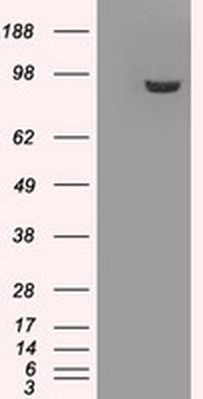 GBE1 Antibody in Western Blot (WB)