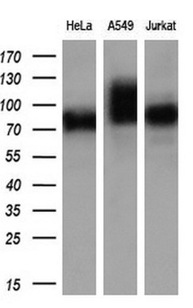 GBE1 Antibody in Western Blot (WB)