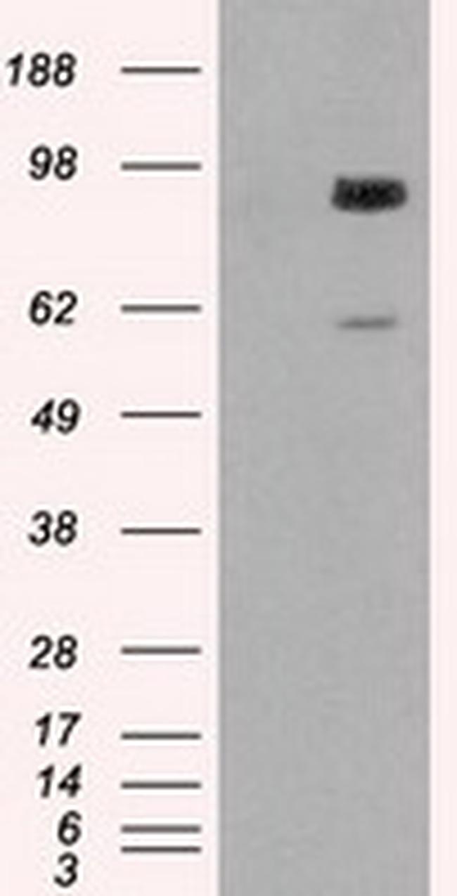 GBE1 Antibody in Western Blot (WB)