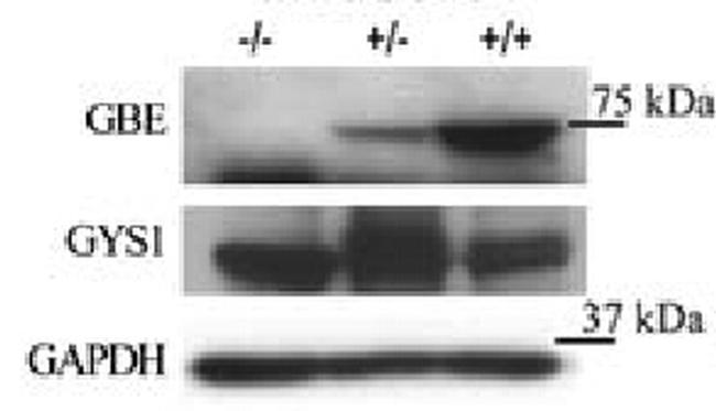 GBE1 Antibody in Western Blot (WB)