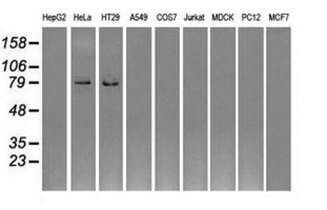 GBE1 Antibody in Western Blot (WB)