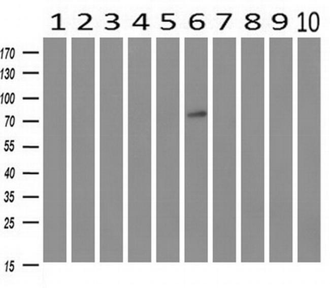 GBE1 Antibody in Western Blot (WB)