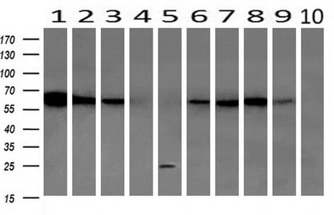 GBP1 Antibody in Western Blot (WB)