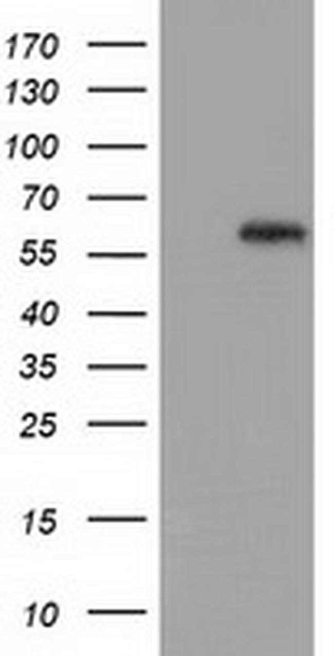 GBP5 Antibody in Western Blot (WB)