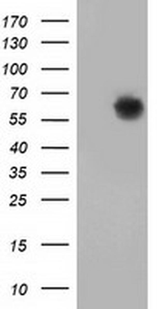 GBP5 Antibody in Western Blot (WB)