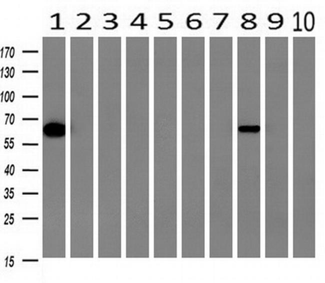 GBP5 Antibody in Western Blot (WB)