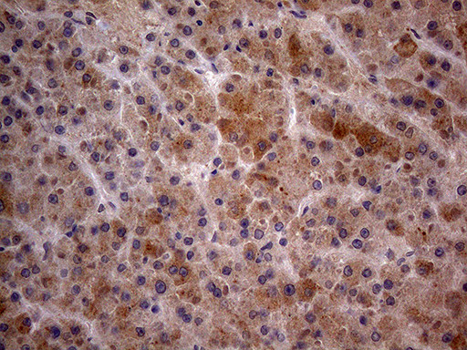 GC Antibody in Immunohistochemistry (Paraffin) (IHC (P))