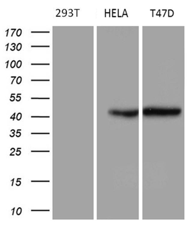 GC Antibody in Western Blot (WB)