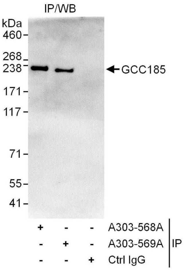 GCC185 Antibody in Immunoprecipitation (IP)