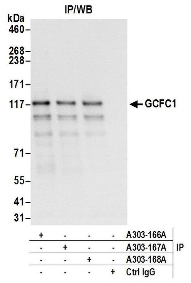 GCFC1 Antibody in Western Blot (WB)