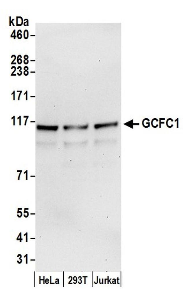 GCFC1 Antibody in Western Blot (WB)