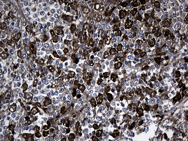 GCH1 Antibody in Immunohistochemistry (Paraffin) (IHC (P))