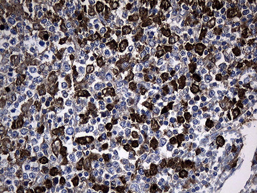 GCH1 Antibody in Immunohistochemistry (Paraffin) (IHC (P))