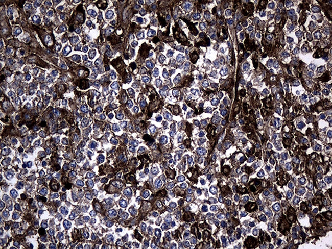 GCH1 Antibody in Immunohistochemistry (Paraffin) (IHC (P))