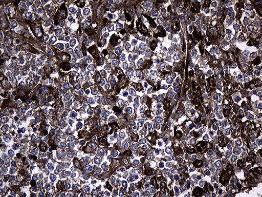 GCH1 Antibody in Immunohistochemistry (Paraffin) (IHC (P))