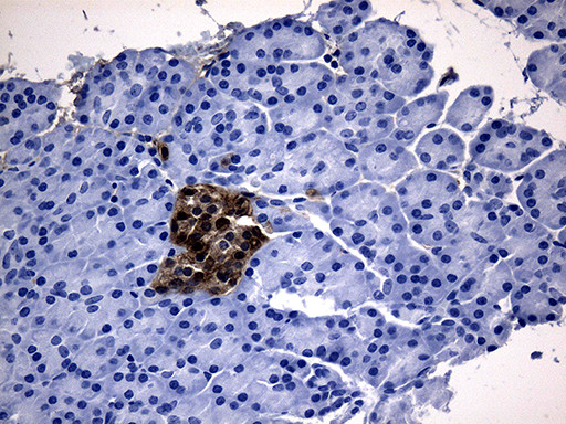 GCH1 Antibody in Immunohistochemistry (Paraffin) (IHC (P))