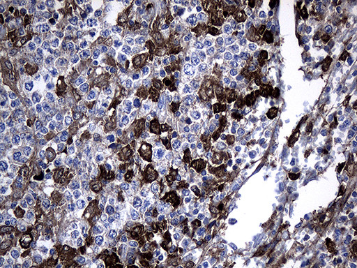 GCH1 Antibody in Immunohistochemistry (Paraffin) (IHC (P))