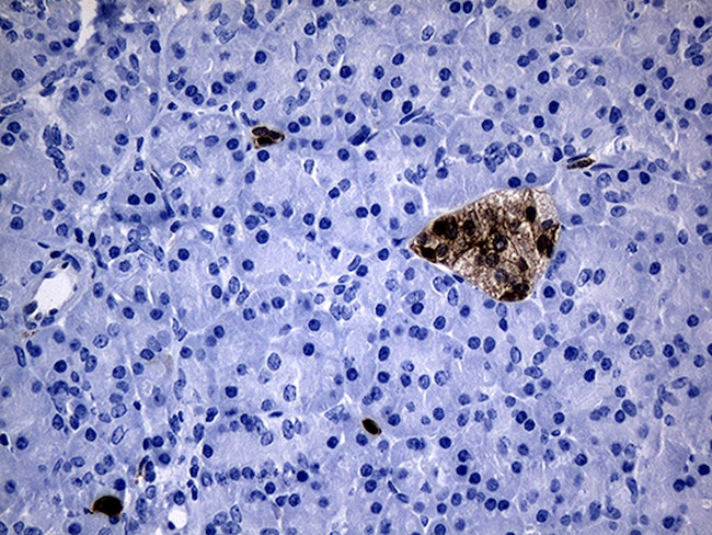 GCH1 Antibody in Immunohistochemistry (Paraffin) (IHC (P))